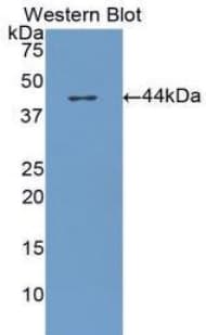 CFH / Complement Factor H Antibody (aa860-1231)