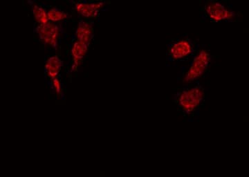 C/EBP Alpha / CEBPA Antibody
