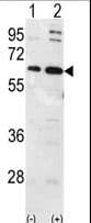 UBQLN1 / Ubiquilin Antibody (aa40-70)