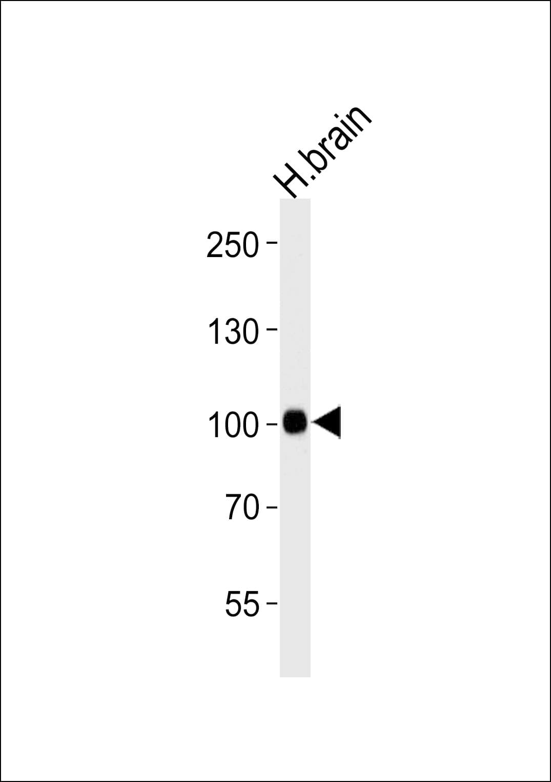 IHC-plus™ CDH13 / Cadherin 13 Antibody (aa589-617)