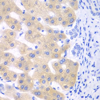 Polyclonal Rabbit anti-Human CYP2C18 / CYP2C Antibody (IHC, WB)
