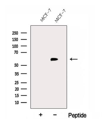 FBXO7 Antibody