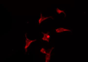 Polyclonal Rabbit anti-Human STAT3 Antibody (IF, WB)
