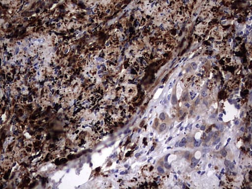 LGALS3 / Galectin 3 Antibody (clone OTI1C7)