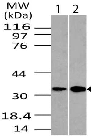 DRAM1 / DRAM Antibody (aa1-230)