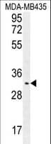 OR4K2 Antibody (aa276-304)