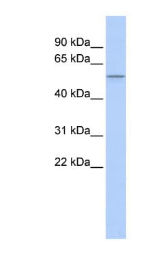 PPARD / PPAR Delta Antibody (N-Terminus)