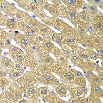 TMED10 / TMP21 Antibody