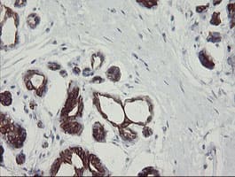 SLA2 / SLAP2 Antibody (clone OTI3A7)