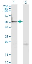 IHC-plus™ MAPK8 / JNK1 Antibody (clone 1E1)