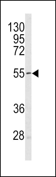 PA26 / SESN1 Antibody (aa312-341)