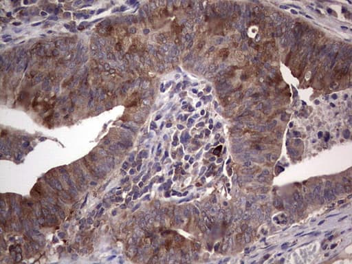 R1 / RRM1 Antibody (aa541-792, clone OTI17C3)