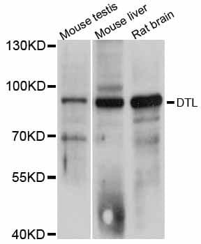 DTL / CDT2 Antibody