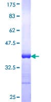 Human CKMT1B Protein (Recombinant GST, N-terminus)