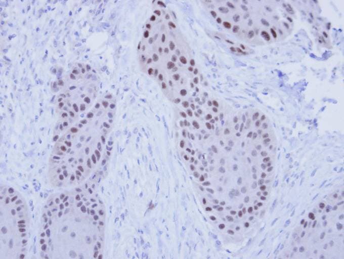RFC4 Antibody (aa18-323)