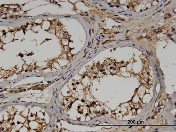 RGS14 Antibody (clone 2F8)
