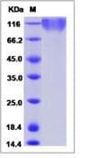 Epstein Barr Virus EBV (strain B95-8) GP350 Protein (Recombinant His,C-terminus)