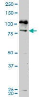 NEK5 Antibody (clone 7G2)