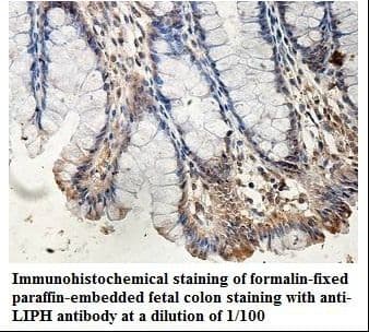 LIPH / Lipase Member H Antibody (aa108-273)