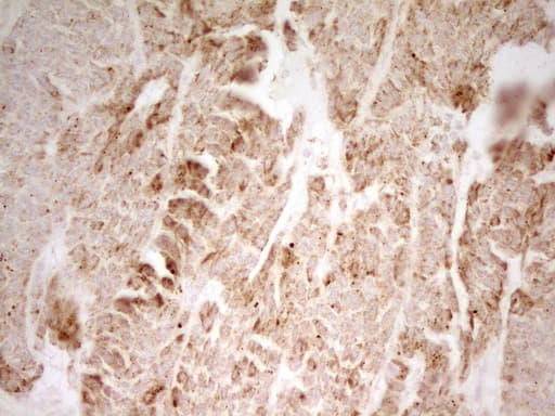 Monoclonal Mouse anti-Human MRRF Antibody (clone OTI2A9, aa56-262, IHC, WB)