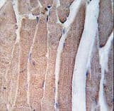 DAPK2 / DAP Kinase 2 Antibody (aa40-70)