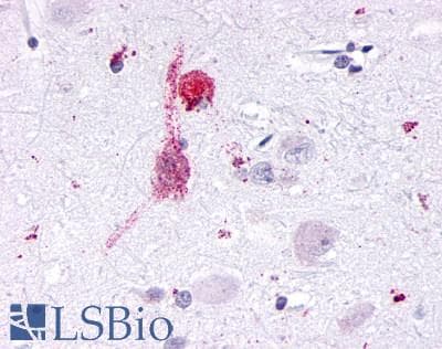 PathPlus™ KISS1R / GPR54 Antibody (Cytoplasmic Domain)