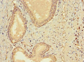 CERKL Antibody
