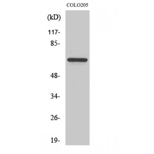 FOXO4 / AFX1 Antibody (140-220 aa)