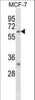 IHC-plus™ Polyclonal Rabbit anti-Human CD276 / B7-H3 Antibody (aa493-522, IHC, IF, WB)