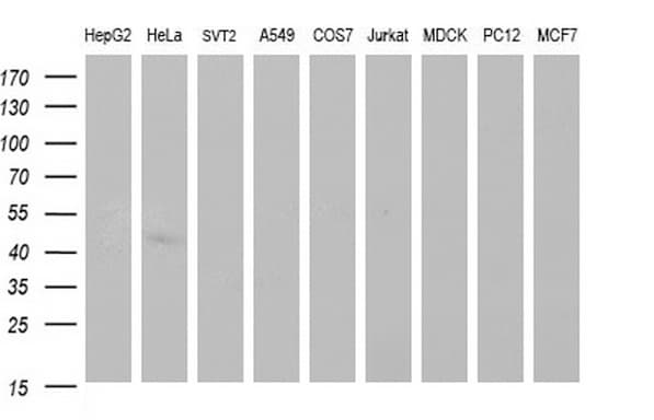 SPHK / SPHK1 Antibody (clone OTI1A6, Carrier-free)