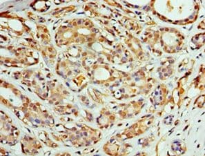 COPS4 / CSN4 Antibody (aa1-310)
