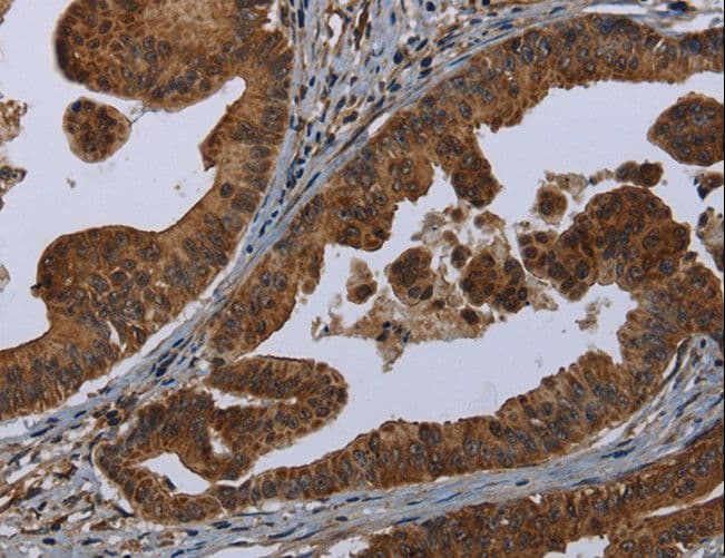HOMER2 / Homer 2 Antibody