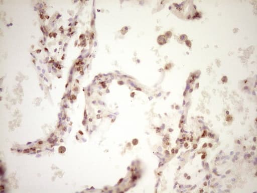 LPIN1 / Lipin 1 Antibody (clone OTI8F10)