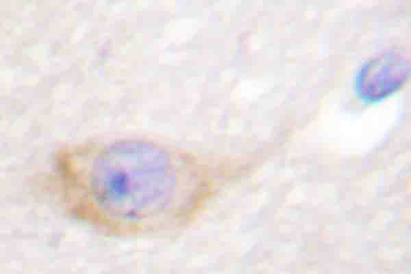 TH / Tyrosine Hydroxylase Antibody (phospho-Ser71)