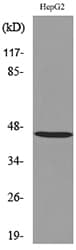 Polyclonal Rabbit anti-Human HOXD3 Antibody (WB)