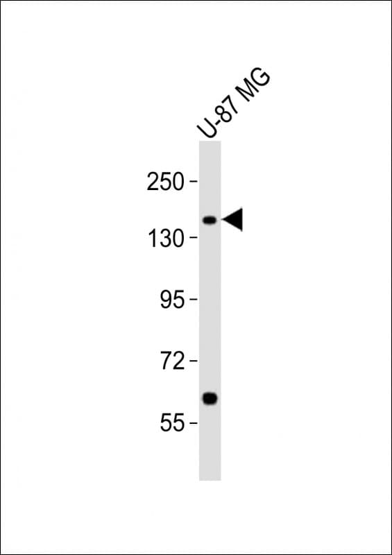 ATP2B3 / PMCA3 Antibody (aa1161-1194)