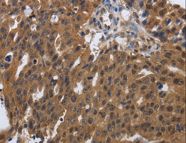 Polyclonal Rabbit anti-Human PDCD7 Antibody (IHC)
