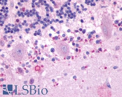 PathPlus™ MTNR1B / MT2 Antibody (Cytoplasmic Domain)