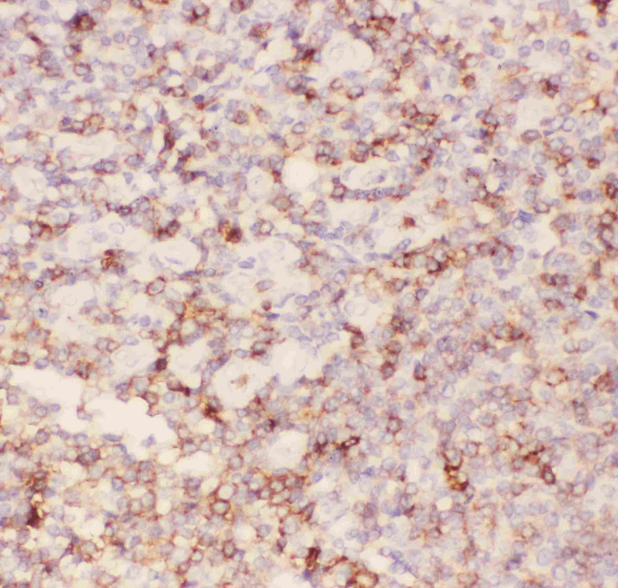 Polyclonal Rabbit anti-Human SPN / CD43 Antibody (aa272-400, IHC, WB)