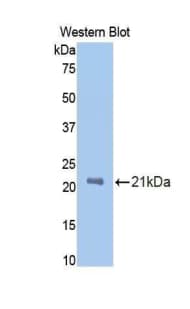 PROCR / EPCR Antibody (aa59-217)