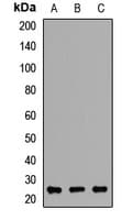 Polyclonal Rabbit anti-Human RAB27B Antibody (WB)