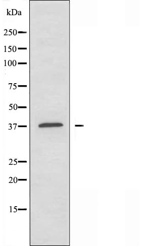 MSY2 / YBX2 Antibody