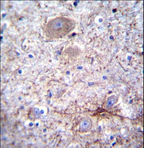 Polyclonal Rabbit anti-Human PCDHA7 Antibody (aa272-300, IHC, WB)