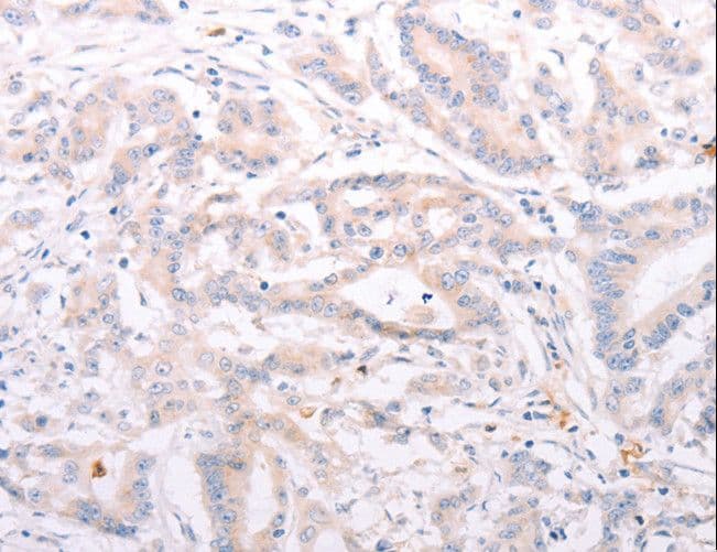 Polyclonal Rabbit anti-Human ANKRA2 / ANKRA Antibody (IHC)