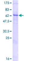 Human MAP1D Protein (Recombinant GST)