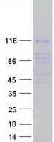 Human RBL2 / RB2 p130 Protein (Recombinant Myc-DDK (Flag))
