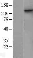 NEP / DDR1 Protein (Over-Expression Lysate Myc-DDK (Flag))