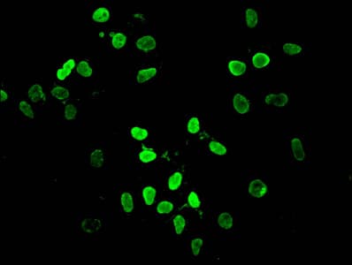 HIST1H4I Antibody