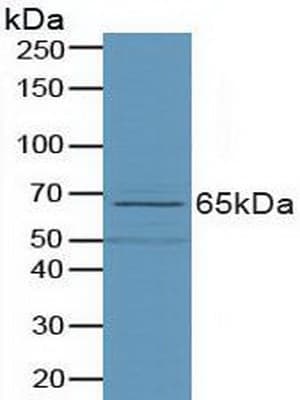 Phospholipase D Antibody (aa725-1074, PE)