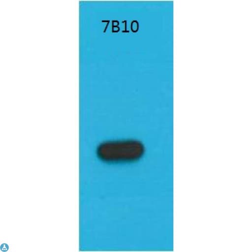S1 Tag Antibody